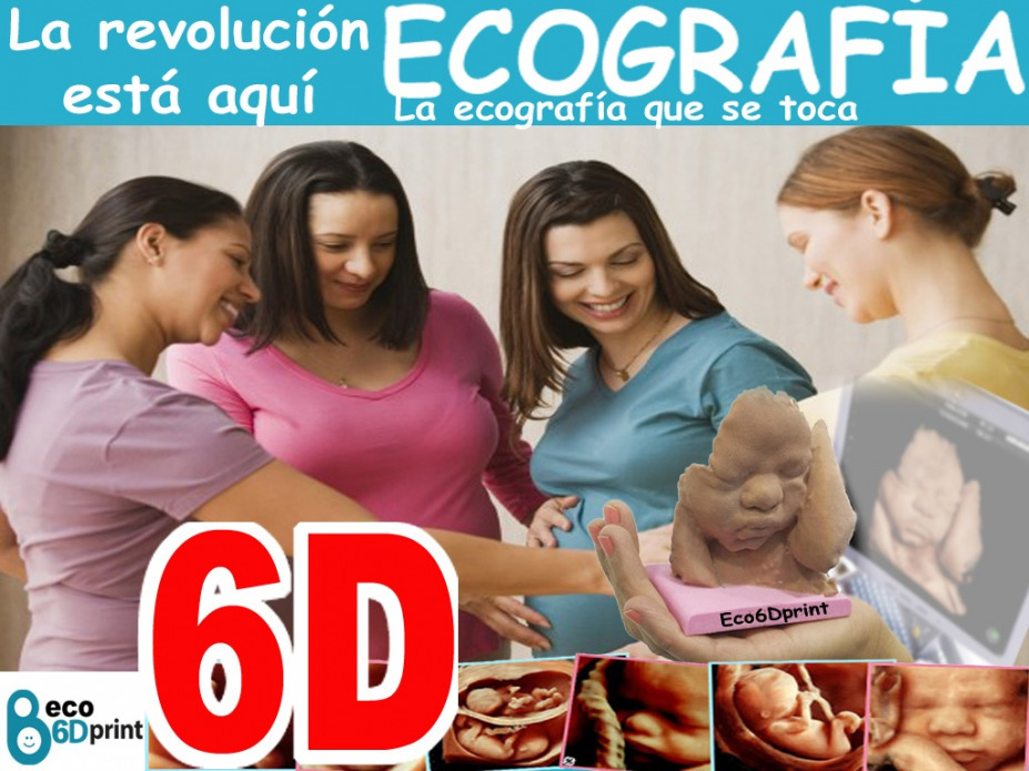 Ecografías 6D 